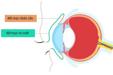 Phẫu thuật Kết mạc, Giác mạc