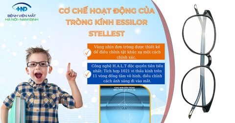 Tròng kính kiểm soát tiến triển cận thị Essilor Stellest -lựa chọn ưu việt nhất hiện nay cho bé