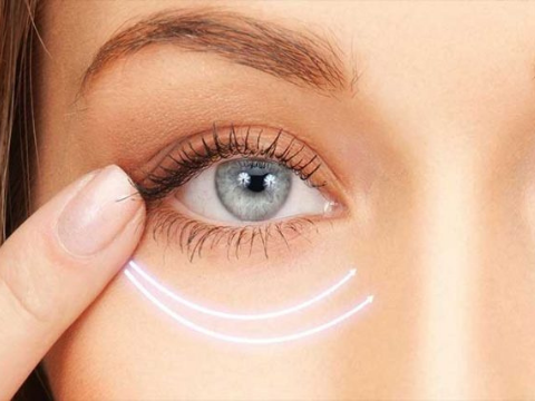 Quặm mi - Phương pháp điều trị quặm mi ở trẻ em và người lớn