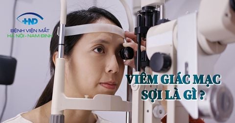 Viêm giác mạc sợi là gì? Nguyên nhân và phương pháp điều trị như thế nào?