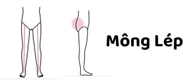 Mông lép