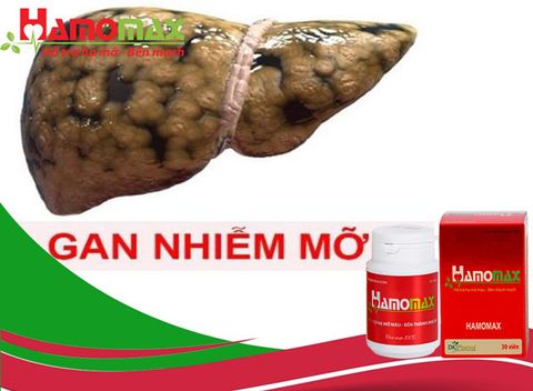 Hamomax chia sẻ bệnh gan nhiễm mỡ độ 3 và cách điều trị hiệu quả nhất hiện nay