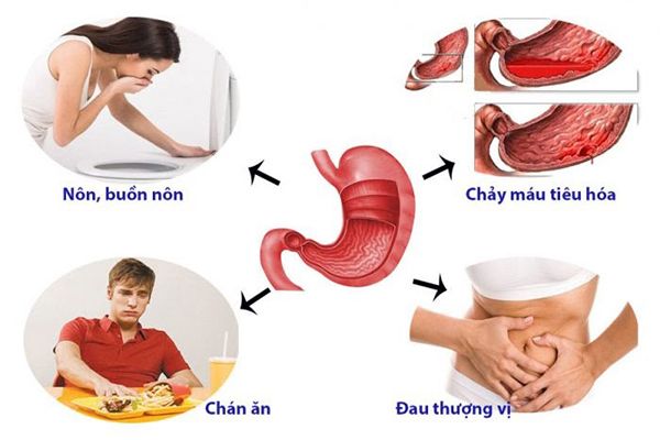 Biểu hiện của bệnh đau dạ dày