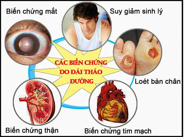 Những biến chứng nguy hiểm của bệnh tiểu đường