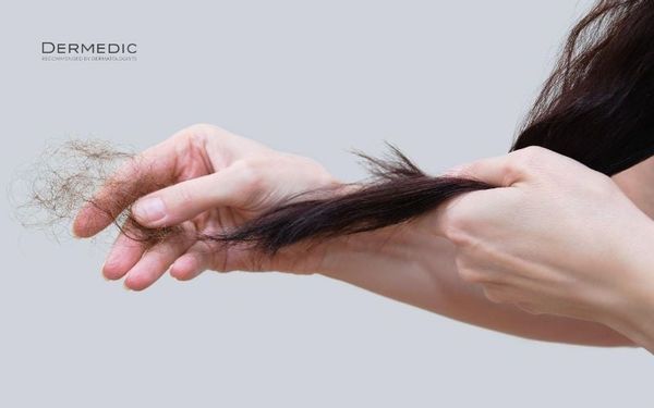 Thói quen chăm sóc tóc không đúng cách khiên tóc yếu