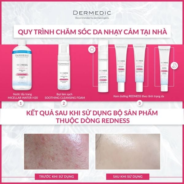 Sử dụng sản phẩm đặc trị cho da nổi mẩn đỏ của dòng Redness Dermeidc