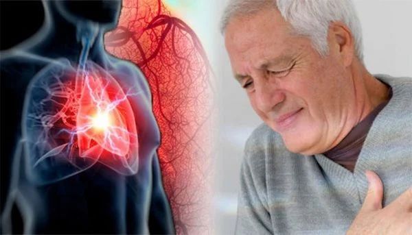 Dấu hiệu cảnh báo nhồi máu cơ tim