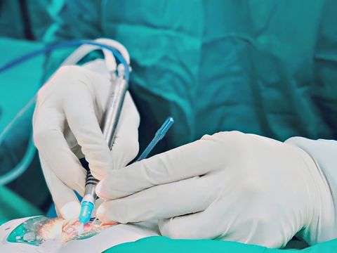 Các Phương Pháp Điều Trị