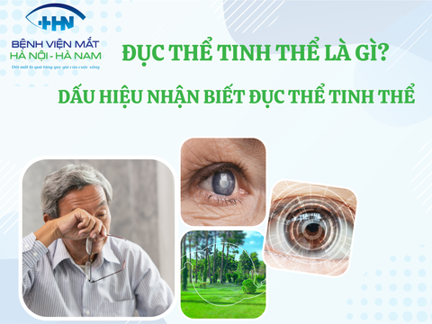 Đục thủy tinh thể là gì? Dấu hiệu nhận biết đục thủy tinh thể