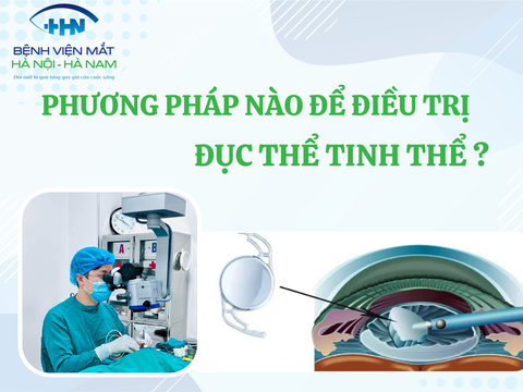 Phương pháp nào để điều trị đục thủy tinh thể?