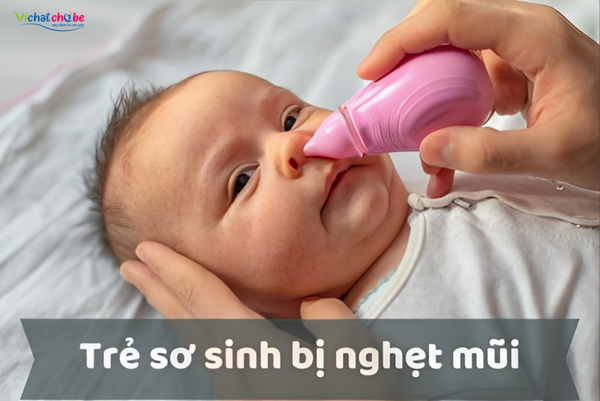 Cách trị nghẹt mũi cho trẻ sơ sinh tại nhà