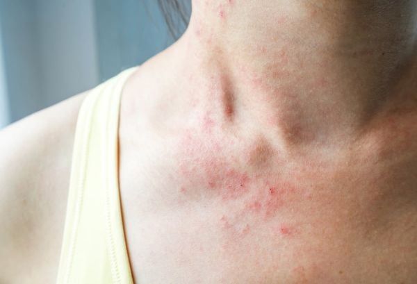 Tác dụng của Omega 6