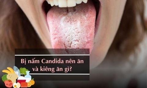BỊ NẤM CANDIDA NÊN ĂN GÌ VÀ KIÊNG ĂN GÌ? TOP 12 THỰC PHẨM