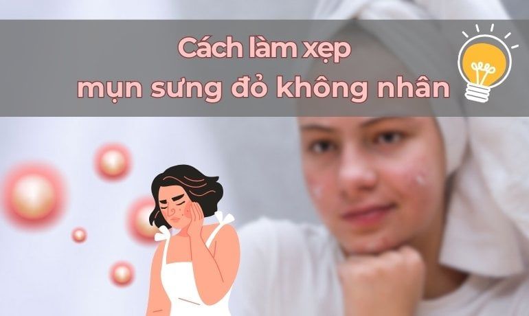 Điều Trị Mụn Sưng Đỏ Có Nhân Tại Nhà vs Thăm Khám Chuyên Gia Da Liễu