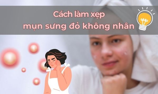 6 CÁCH LÀM XẸP MỤN SƯNG ĐỎ KHÔNG NHÂN AN TOÀN TẠI NHÀ