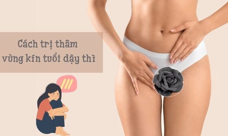 4. Những lưu ý khi áp dụng biện pháp làm sáng vùng kín