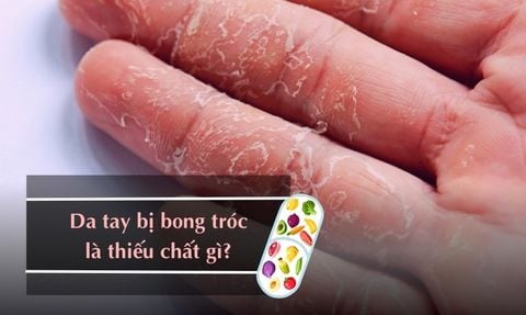 DA TAY BỊ BONG TRÓC LÀ THIẾU CHẤT GÌ? CÁCH NGĂN NGỪA