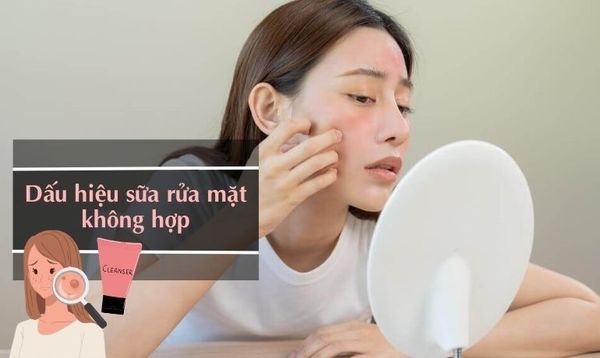 DẤU HIỆU SỮA RỬA MẶT KHÔNG HỢP? CÁCH THỬ XEM CÓ DỊ ỨNG KHÔNG?