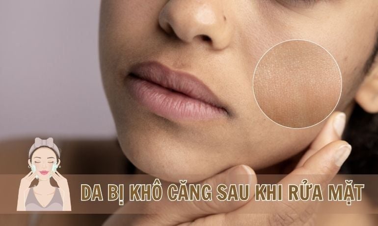 RỬA MẶT XONG DA BỊ KHÔ CĂNG VÌ SAO? TIPS CHỌN SỮA RỬA MẶT PHÙ HỢP – Natonic  Vietnam