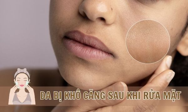 VÌ SAO RỬA MẶT XONG DA THƯỜNG BỊ KHÔ CĂNG VÀ CÁCH KHẮC PHỤC HIỆU QUẢ