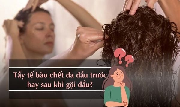 TẨY TẾ BÀO CHẾT DA ĐẦU TRƯỚC HAY SAU KHI GỘI ĐẦU THÌ ÍT RỤNG TÓC?