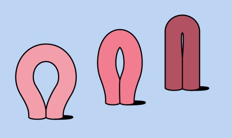 Rửa nước chè xanh cho vùng kín có tốt không? Cách vệ sinh an toàn