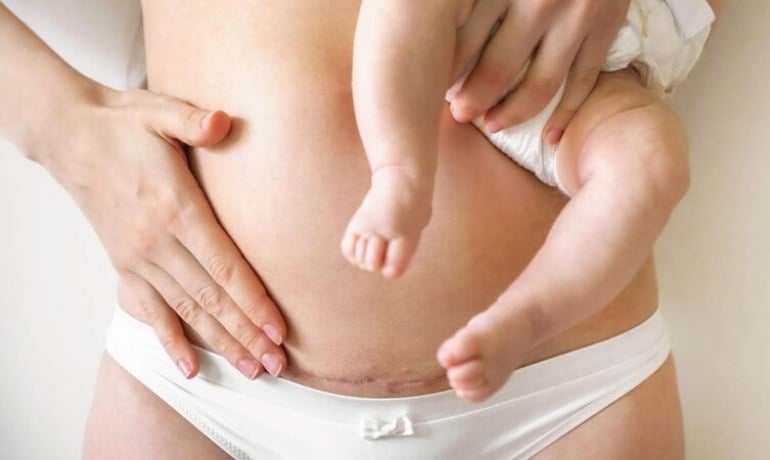 Rửa nước chè xanh cho vùng kín có tốt không? Cách vệ sinh an toàn