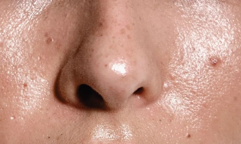 Glycerin thực vật là gì trong mỹ phẩm và có tác dụng gì?