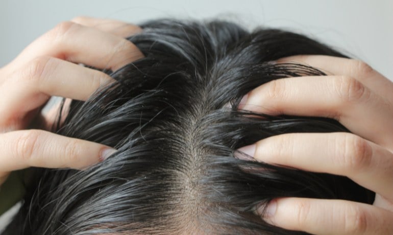 Nên gội đầu bằng nước ấm hay nước lạnh để giảm gàu, ngừa rụng?