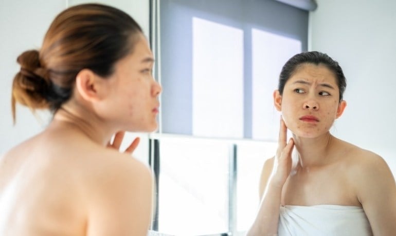 Da mặt bị khô bong tróc phải làm sao, cách chăm sóc đúng?