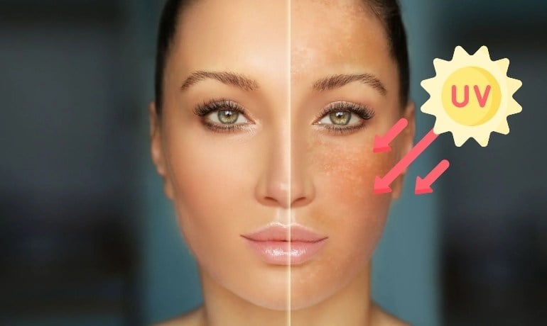 Da mặt bị khô bong tróc phải làm sao, cách chăm sóc đúng?