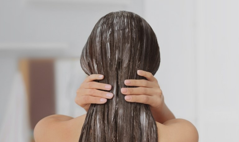 Bị gàu có nên gội đầu nhiều không và cách gội đúng
