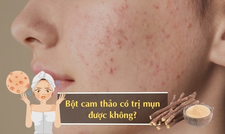 Bột cam thảo có làm trắng da không? 6 công thức mặt nạ