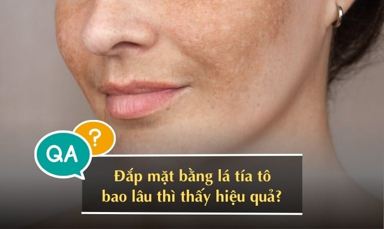 10 cách đắp mặt nạ bằng lá tía tô làm mờ nám tại nhà
