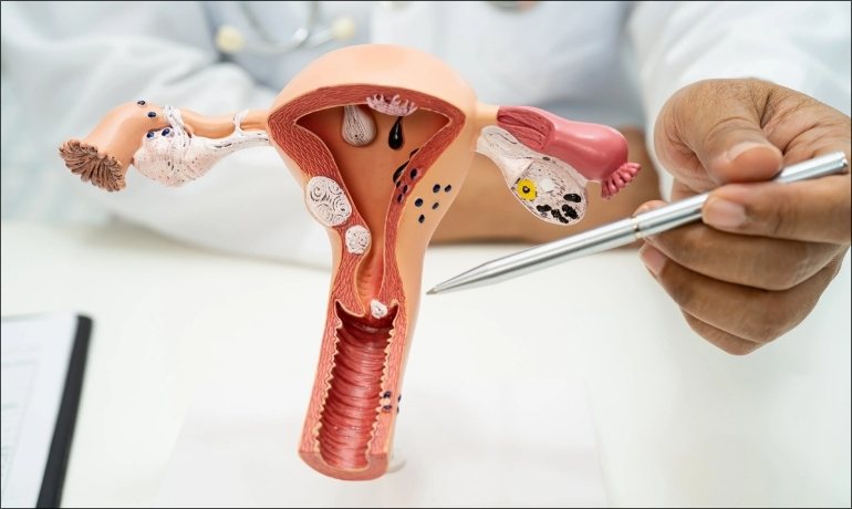 Có nên dùng sữa tắm để rửa vùng kín? Tác hại có thể gặp