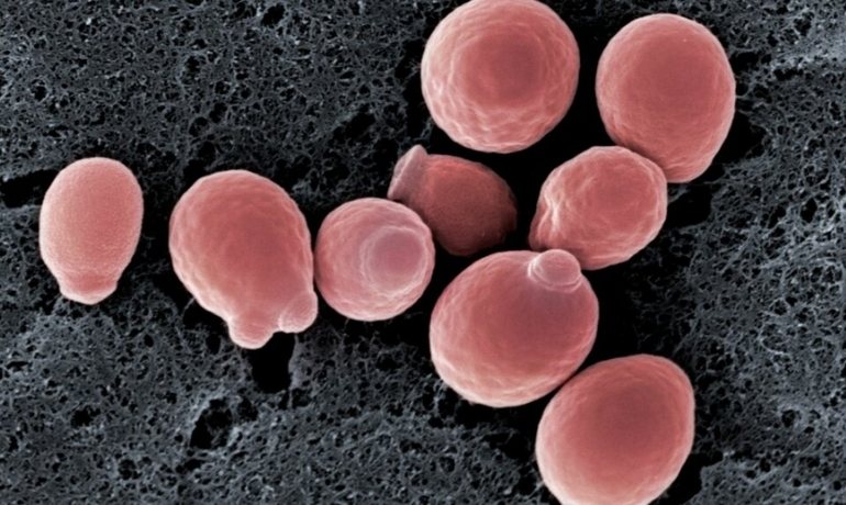 Có nên dùng sữa tắm để rửa vùng kín? Tác hại có thể gặp