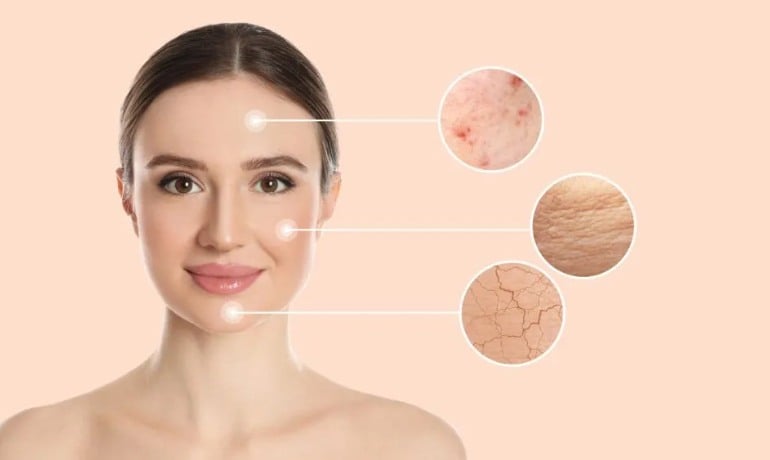 Glycerin thực vật là gì trong mỹ phẩm và có tác dụng gì?