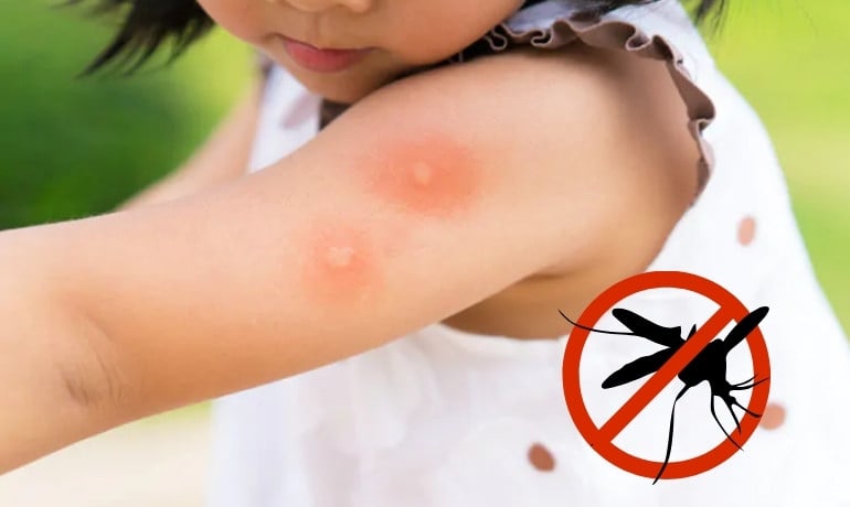 PMD là gì trong sản phẩm đuổi muỗi, có an toàn không?