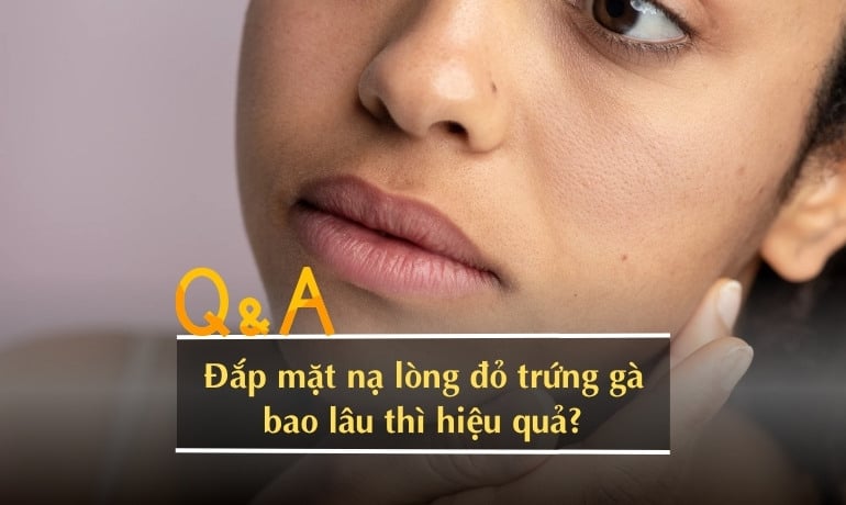 14 cách làm mặt nạ lòng đỏ trứng gà trị nám tại nhà