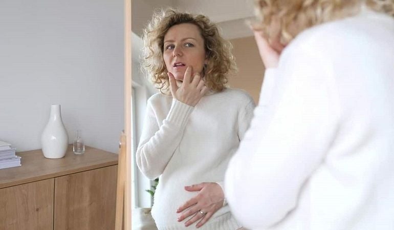Lý giải các vị trí nổi mụn khi mang thai và hướng dẫn điều trị