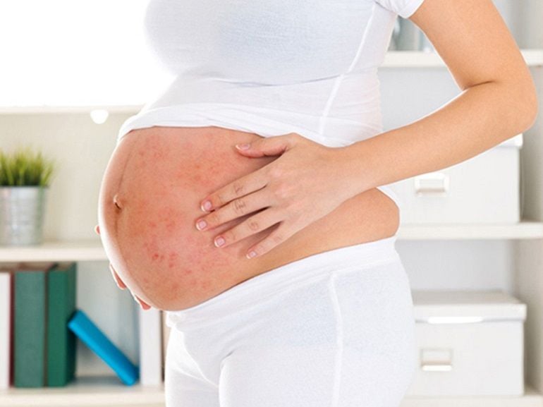 Lý giải các vị trí nổi mụn khi mang thai và hướng dẫn điều trị