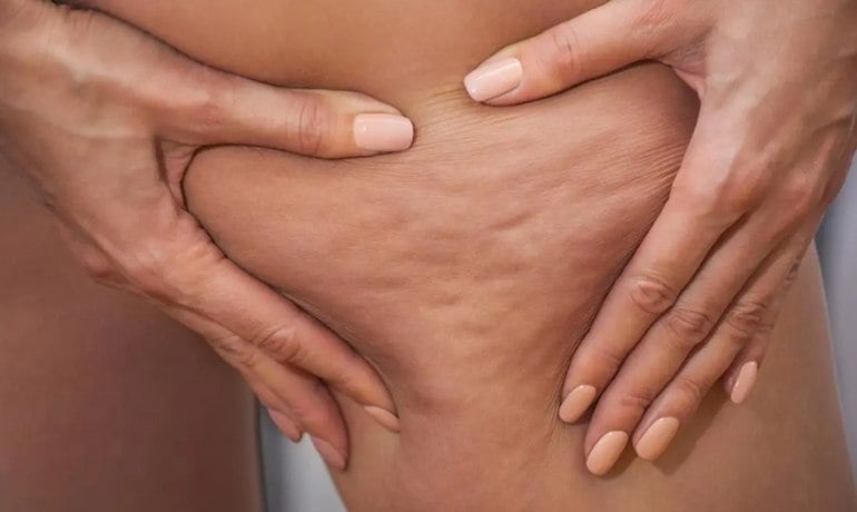 Chải khô, dry brusing là gì và cách sử dụng bàn chải khô body, da mặt?
