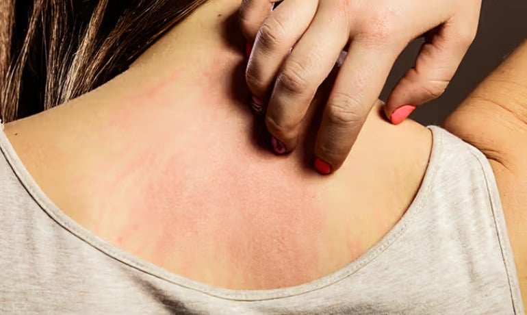 Chải khô, dry brusing là gì và cách sử dụng bàn chải khô body, da mặt?