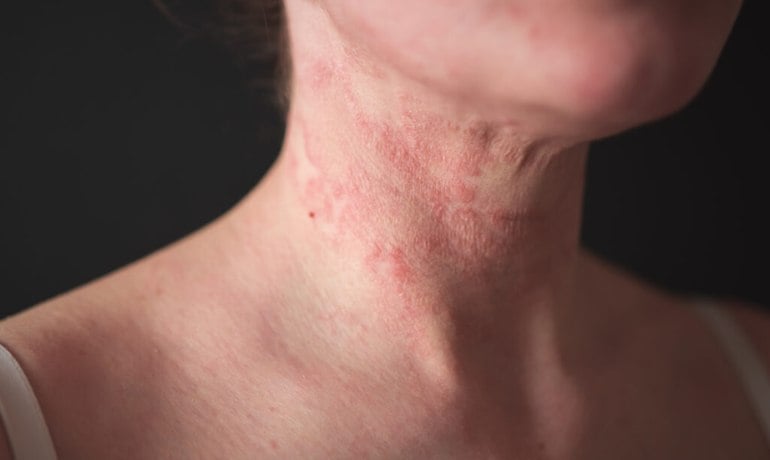 Chải khô, dry brusing là gì và cách sử dụng bàn chải khô body, da mặt?