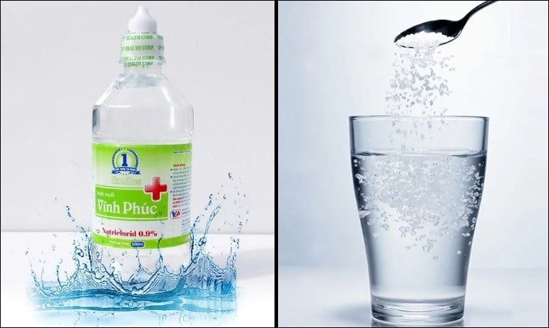 Có nên rửa vùng kín bằng nước muối sinh lý? Sai lầm phổ biến