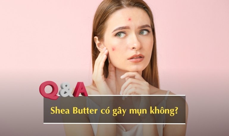 Shea Butter (bơ hạt mỡ) là gì? Có an toàn cho da không?