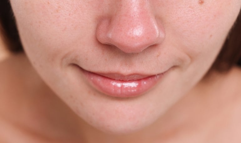 Cách phân biệt và điều trị các loại mụn trên khuôn mặt