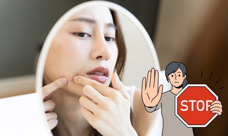 Cách phân biệt và điều trị các loại mụn trên khuôn mặt