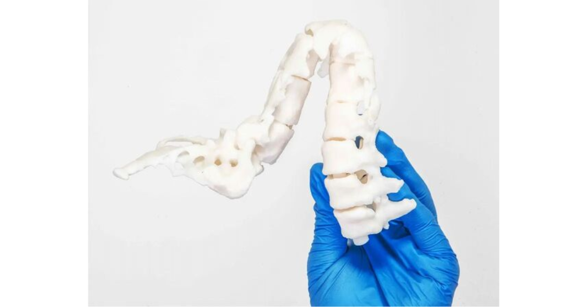 In 3D xương ứng dụng trong Y tế