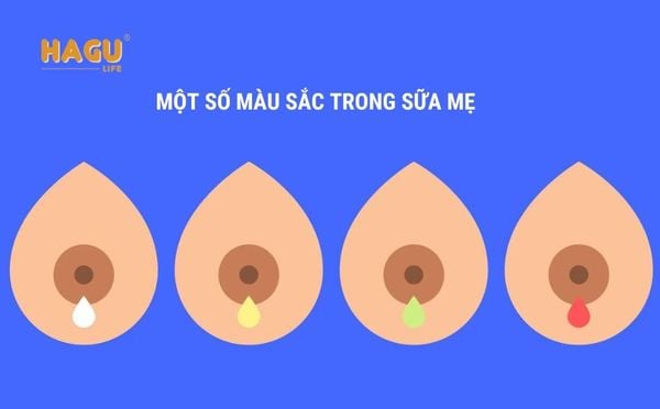 Màu sắc trong sữa mẹ có thể thay đổi không?